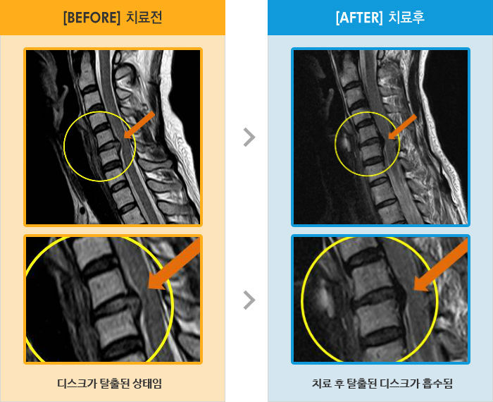 뱸ڻѹ溴_MRI ġ  