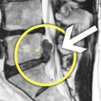 MRIġ���� �̹���