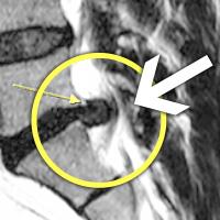 MRIġ���� �̹���