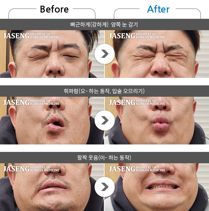 ������ڻ��ѹ溴�� ġ���� �ȸ�Ű渶�� ġ����-���� ���� �� �ȿ����̰� ���� ������ ������ ����.