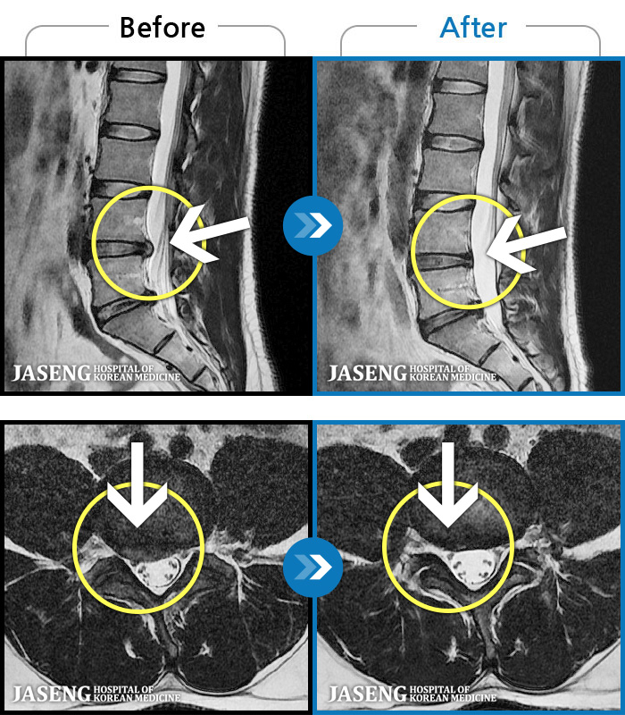 ڻǿ ġ MRI  ġ- 㸮 㸮 ̸   ִ.