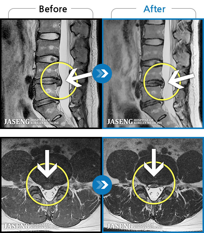 ڻǿ ġ MRI  ġ- 㸮  