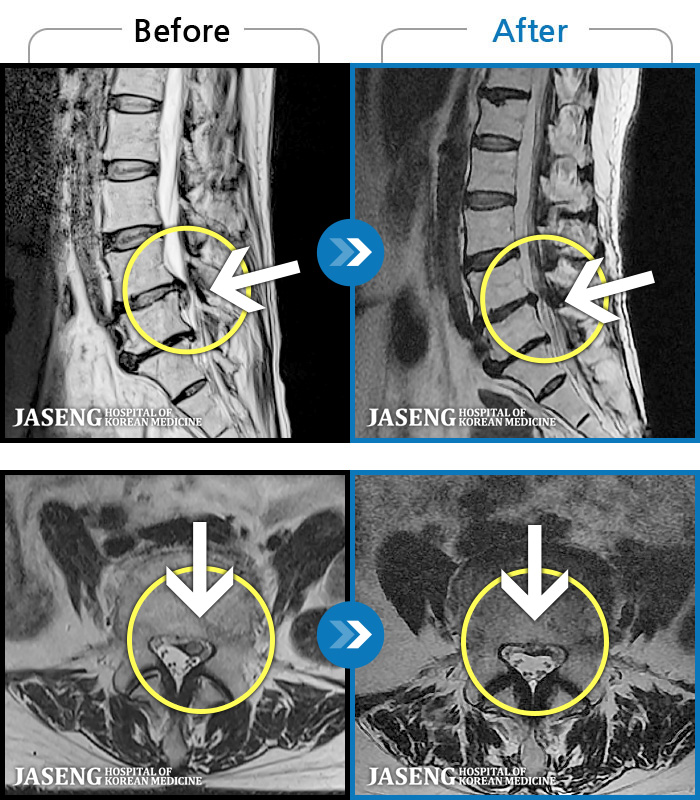ϻڻѹ溴 ġ MRI ġ-㸮, ݺ ٸ ӵǰ ٸ