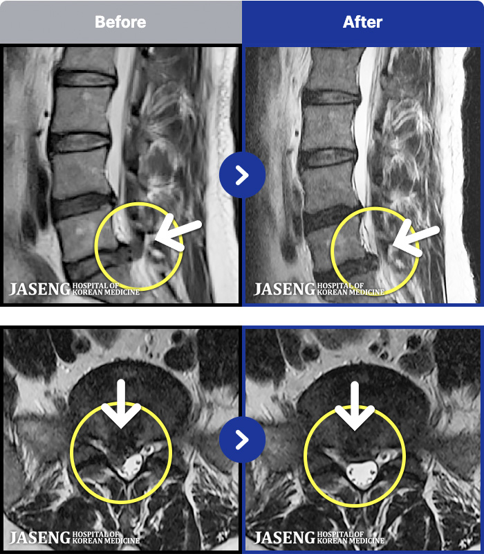 âڻѹ溴 ġ MRI ġ- ĸ ü , ٷ
