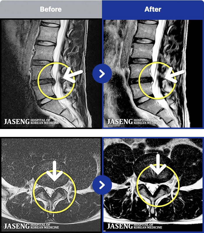 õ���ڻ��ѹ溴�� ġ���� MRI�� ���� ġ����-�㸮 ���� ����� ������ ��ħ�� �� �㸮 ������ �����ߴ�.