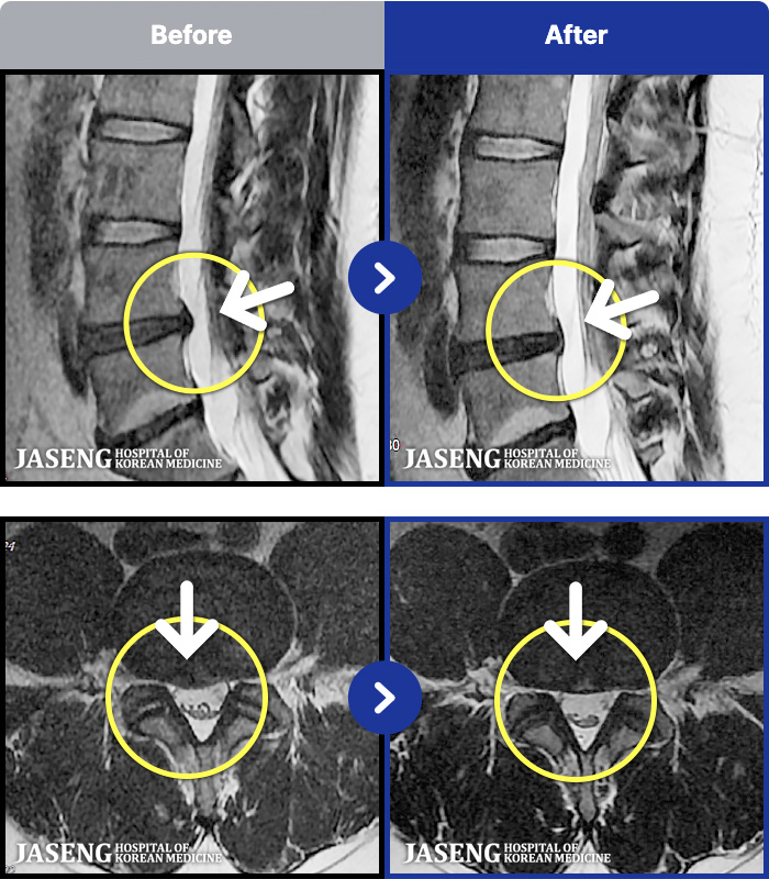 ڻѹ溴 ġ MRI ġ- 㸮 ħ Ͼ ؿ.