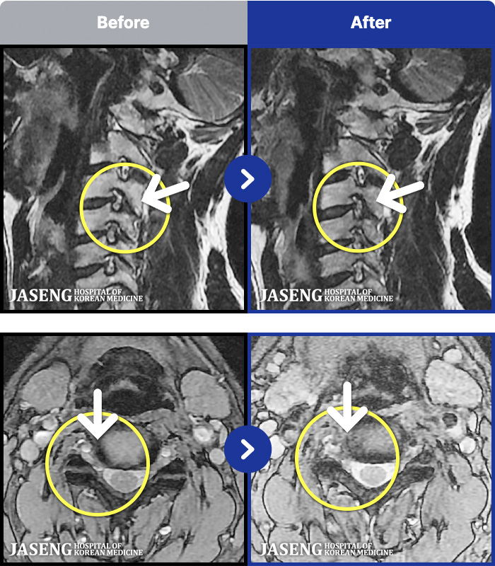ڻѹ溴 ġ MRI ġ-ð ʴ