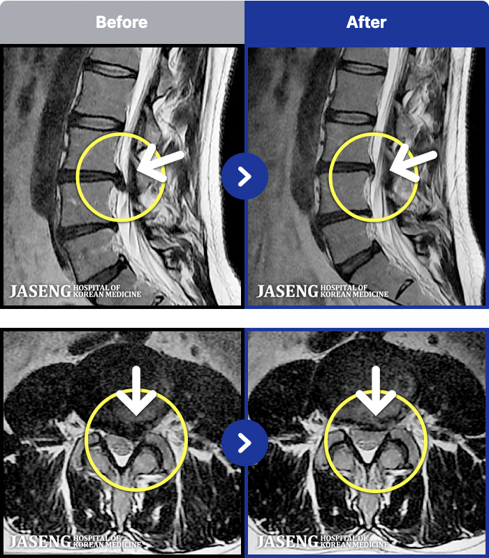 ڻѹ溴 ġ MRI ġ- Ƹ .