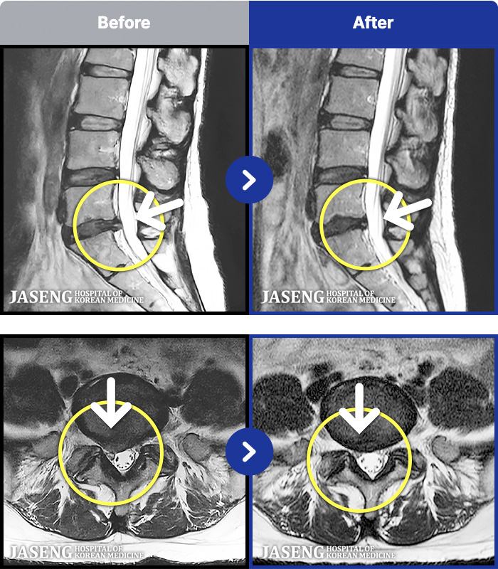 �����ڻ����ǿ� ġ���� MRI�� ���� ġ����-���� �� ������ �ٸ��� ���¥�� ������ ��������� �����̸� �ɾ���.