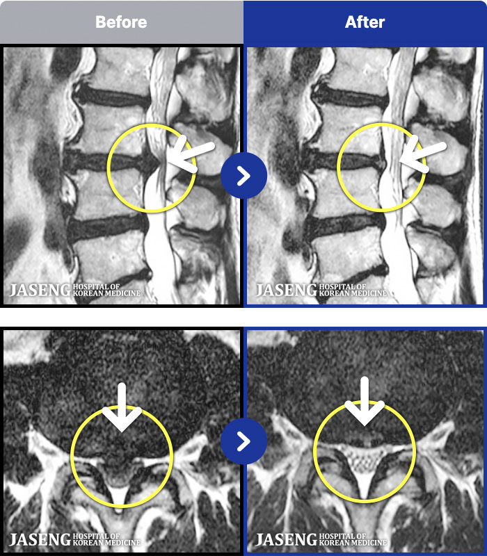 �����ڻ����ǿ� ġ���� MRI�� ���� ġ����-�߻��� ����� ���� ��ġ ���� ������ ����, Ư�� �߰��� ������ ���� ���� ��ָ� �޾����ϴ�.