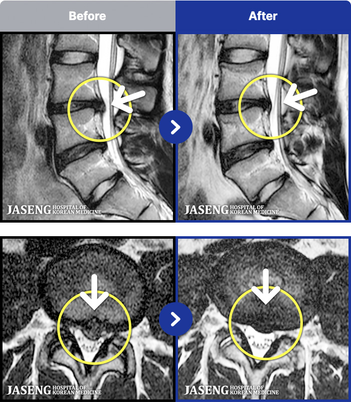 �����ڻ����ǿ� ġ���� MRI�� ���� ġ����-��ð� �ɾ� �ִ� ��Ȱ�� �����ϴ� �� ���� ������ ������ ����� �������� ���� ������ �߻�
