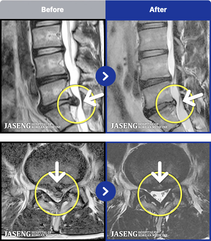 �����ڻ����ǿ� ġ���� MRI�� ���� ġ����-���� �㸮 ������ ���� ����� ���� 
