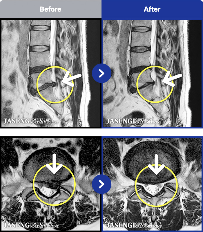 �ڻ��ѹ溴�� ġ���� MRI�� ���� ġ����-�㸮���� �� ���� �ٸ� �������� ���� ���ϰ� �ϻ��Ȱ�� �Ұ����߽��ϴ�.