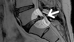MRI  1