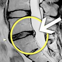 MRI ġ 