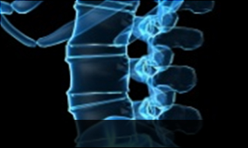 자생한방병원 허리질환 척추전방전위증-정상적인 사람의 척추뼈 모습입니다.